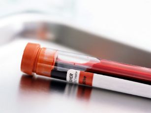 vial of blood