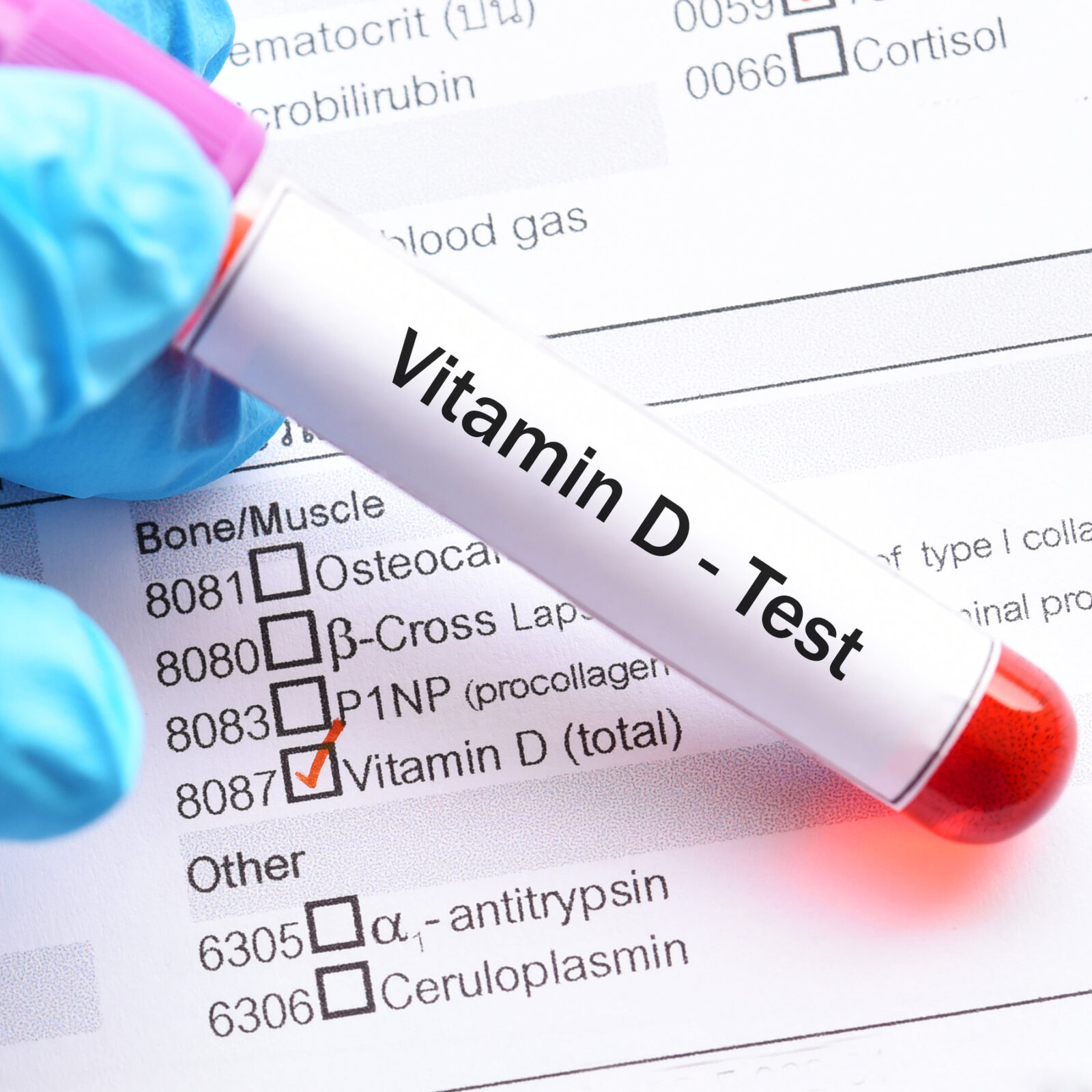 Vitaminas D